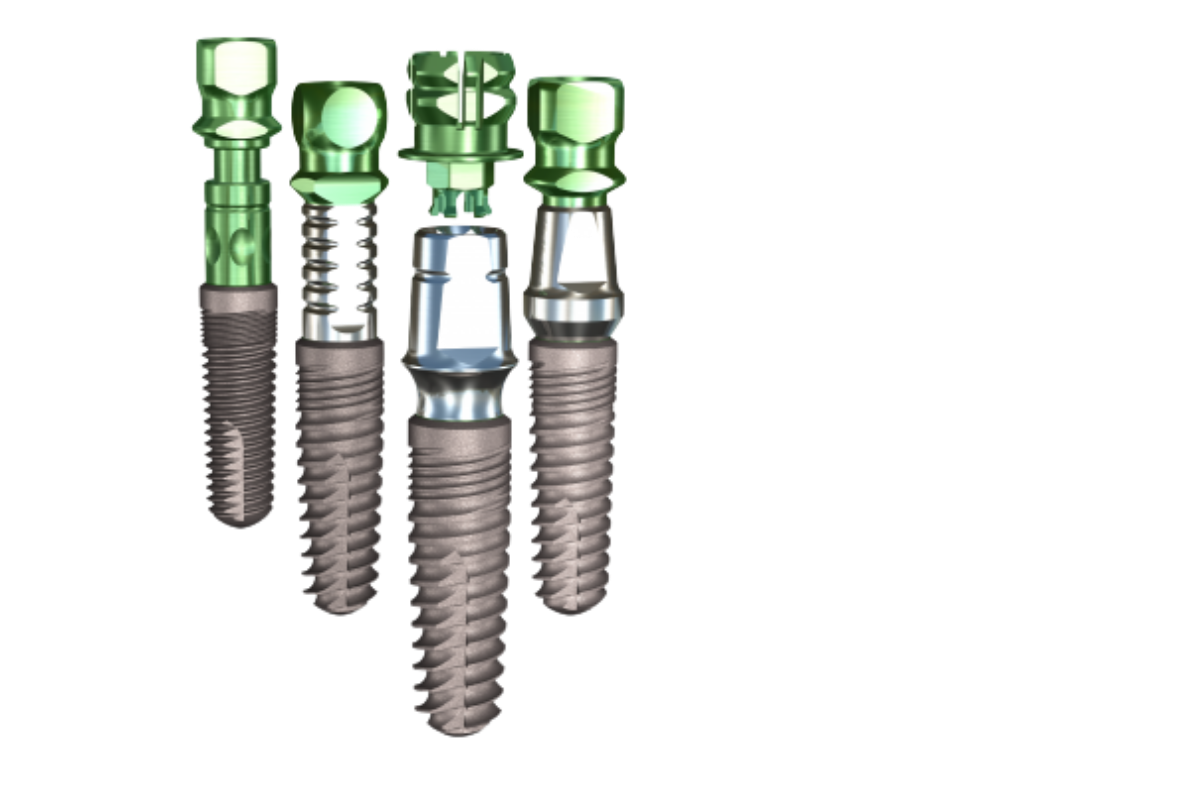 What are Dental Implants?